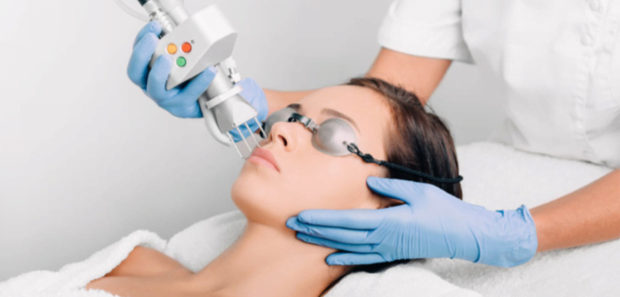 Q-Switch Laser for Hair Bleaching Treatment in Islamabad