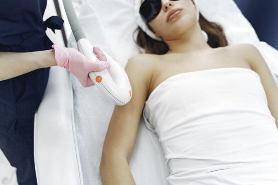 Is Laser Hair Removal Permanent