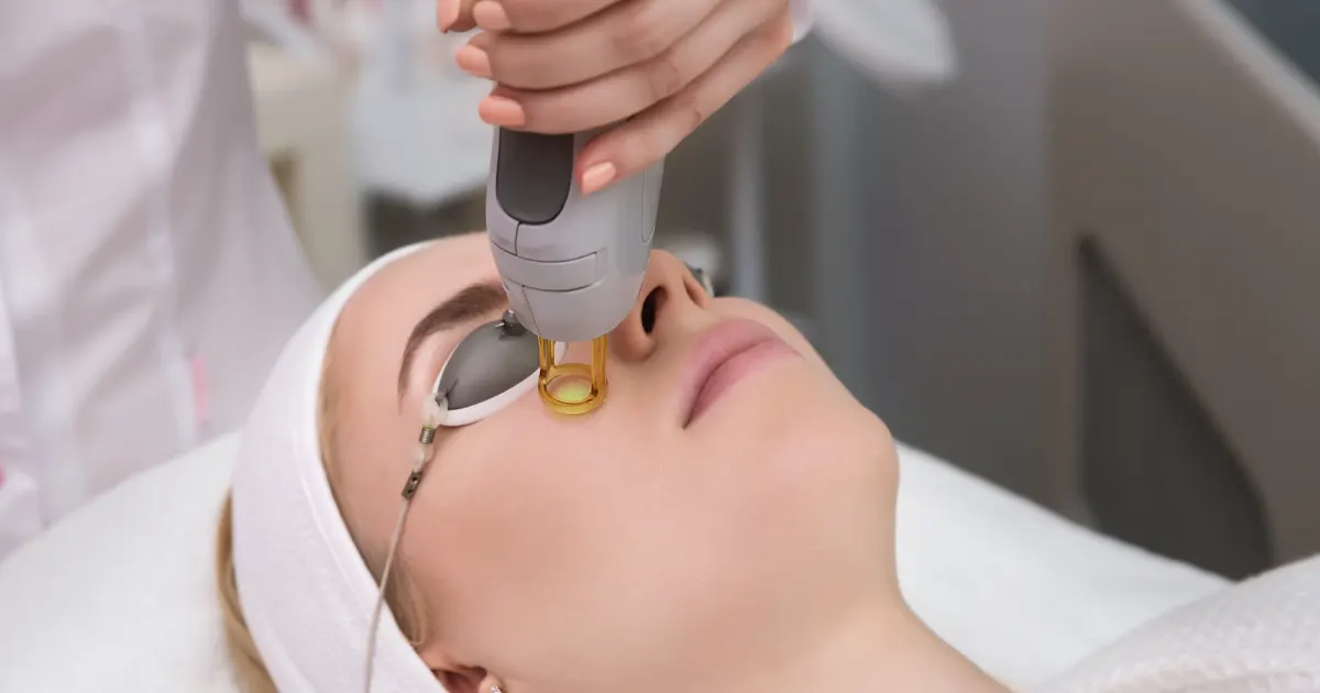 Skin Laser Treatment Skin Laser Treatment