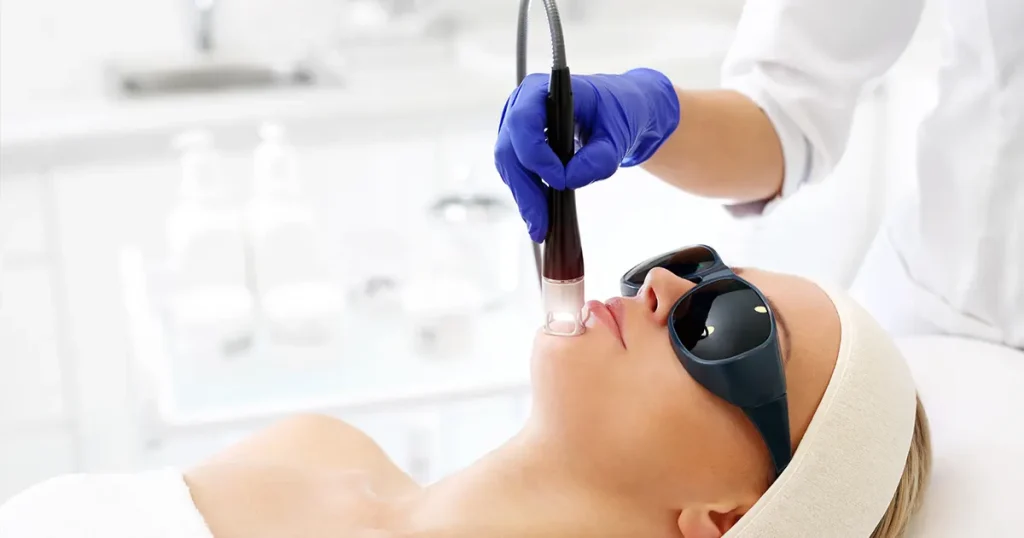 Best Cryo Facial Services in Islamabad