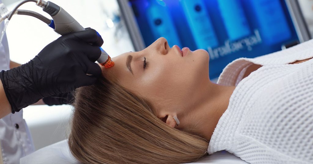 HydraFacial for acne prone skin
