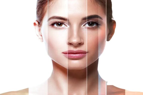 Laser Skin Lightening for Black Skin
