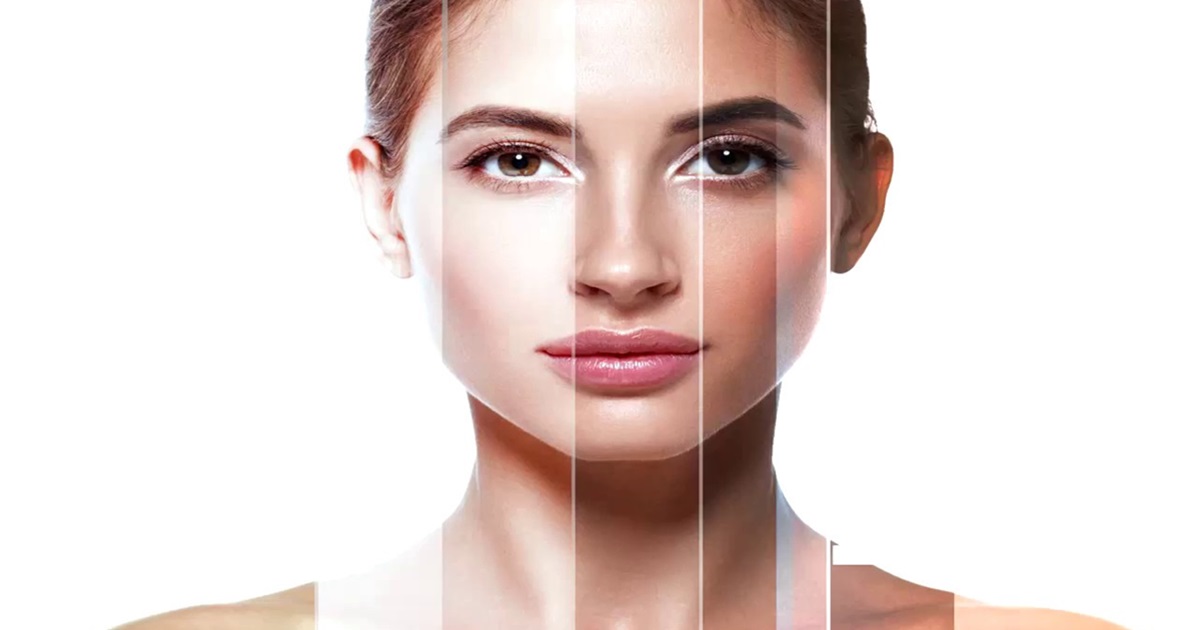 Laser Skin Lightening for Black Skin