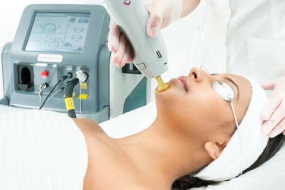 Permanent Facial Hair Removal for Women