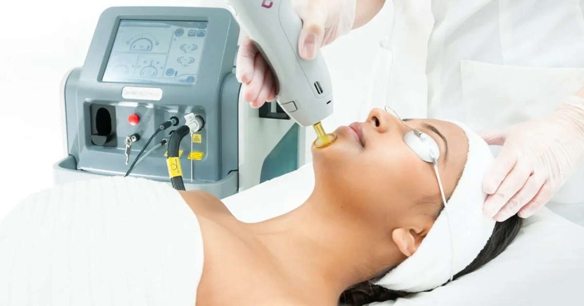 Permanent Facial Hair Removal for Women