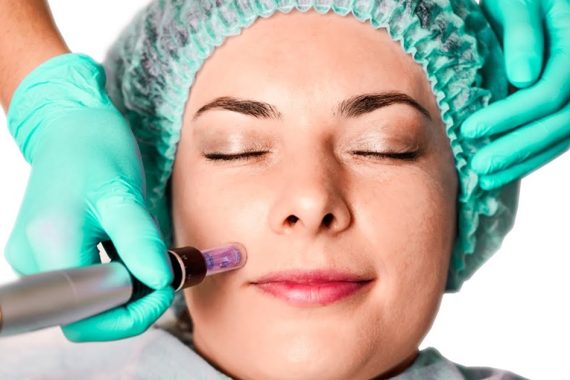 The Amazing Benefits of Microneedling for Your Face