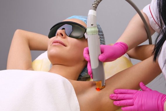 Underarm Laser Hair Removal