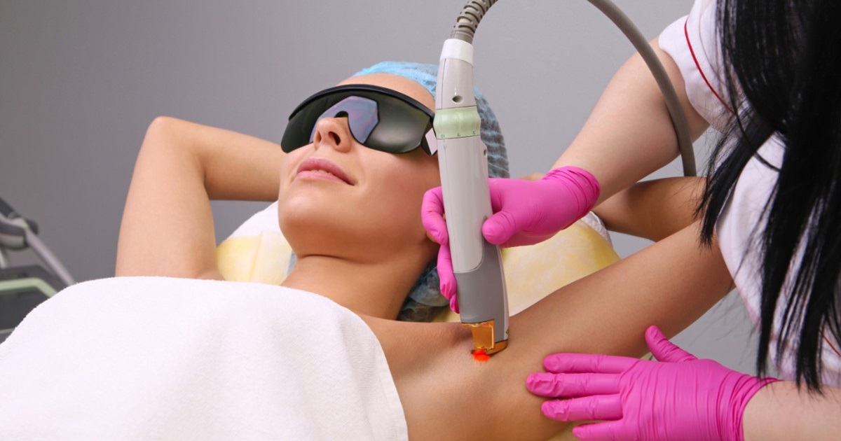 Underarm Laser Hair Removal