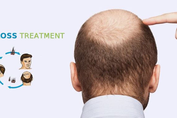 Which Season is Best for Hair Transplant