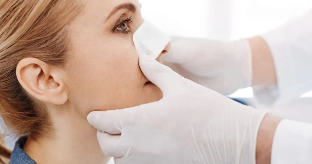 rhinoplasty in Islamabad