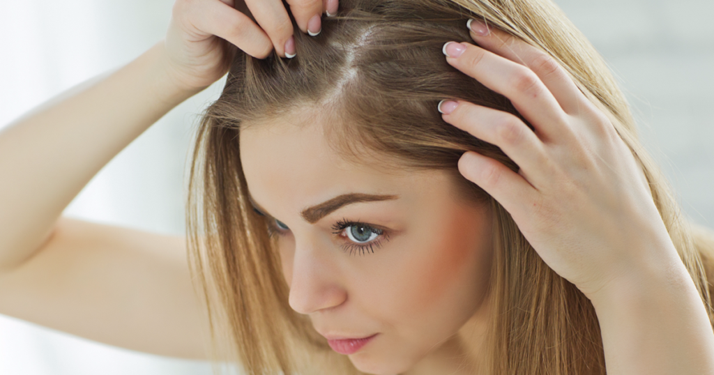 Hair Transplant for Womens Hair Loss