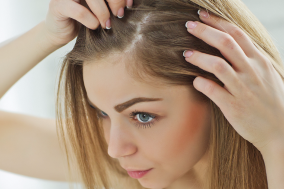 Hair Transplant for Womens Hair Loss