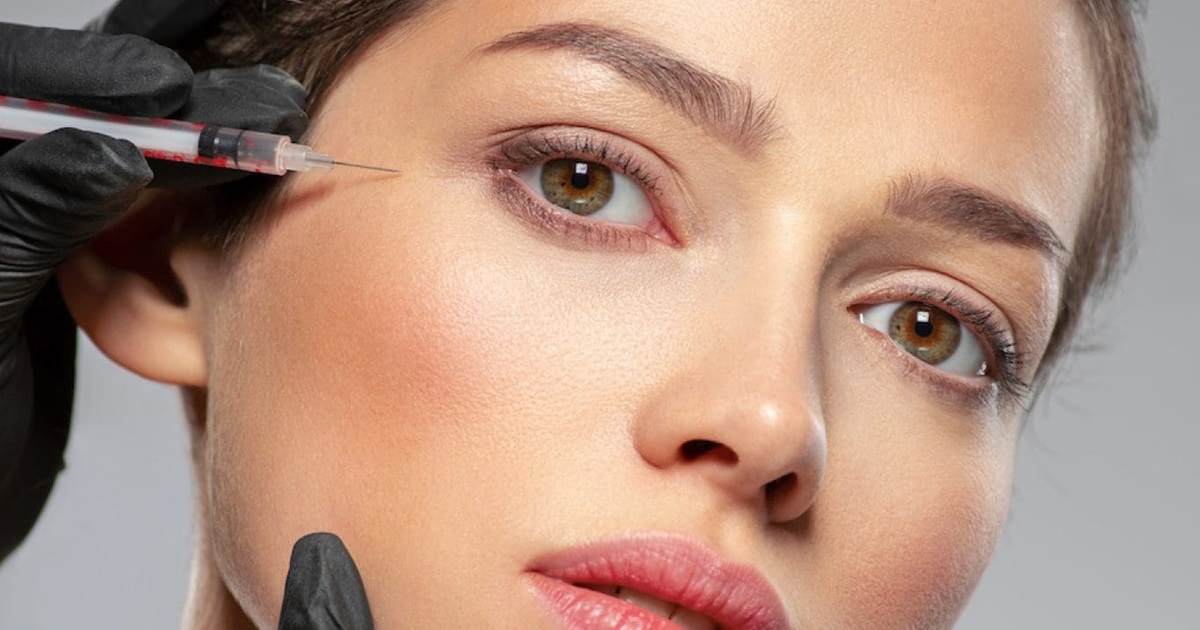 How Long Does It Take for Eye Filler to Settle