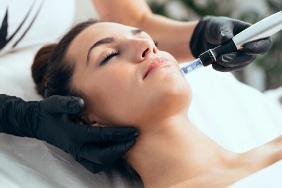 How Often to Get Microneedling