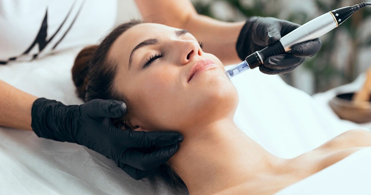 How Often to Get Microneedling