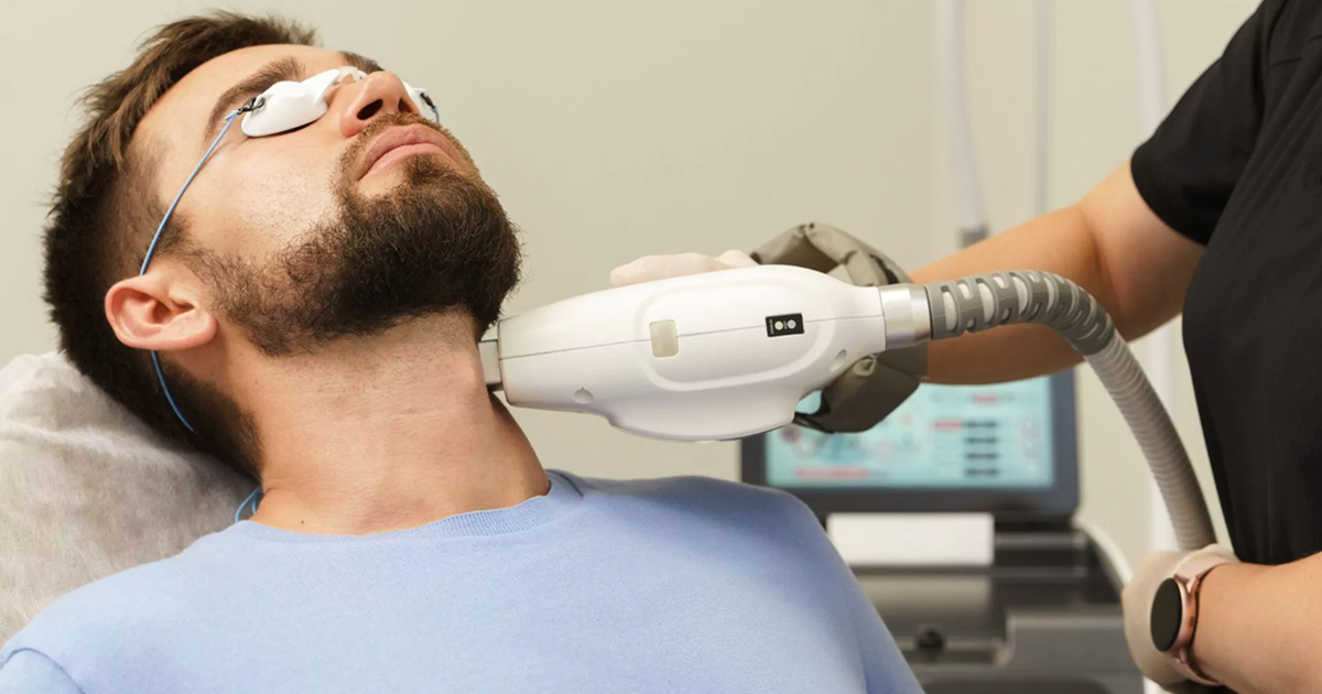Permanent Beard Removal for Men