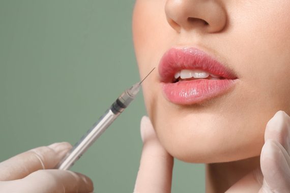 pros and cons of lip fillers