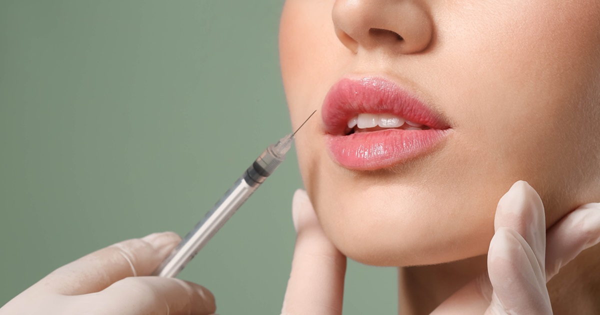pros and cons of lip fillers