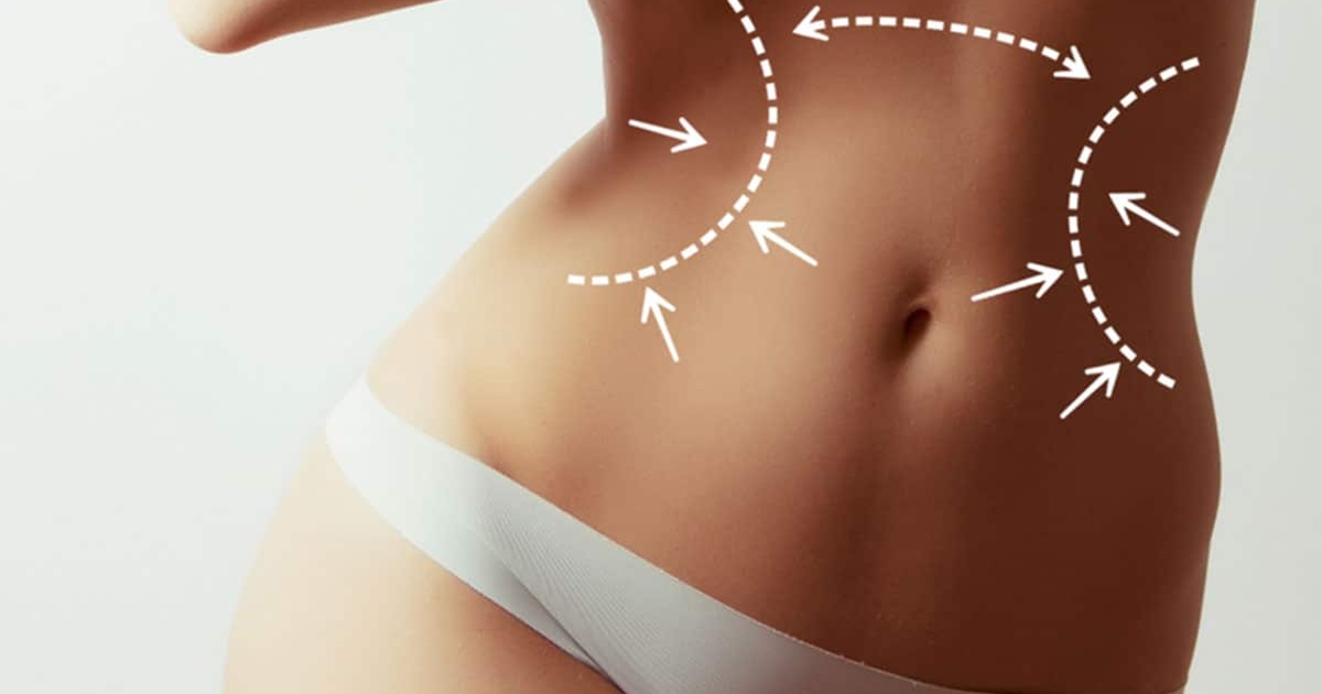Achieve Your Dream Body With Vaser Liposuction