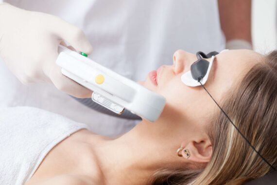 The Most Effective Laser Treatment for the Face