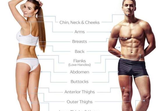 What Areas Can Be Treated with Liposuction