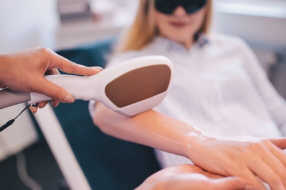 Which Laser Is Safe for Hair Removal?