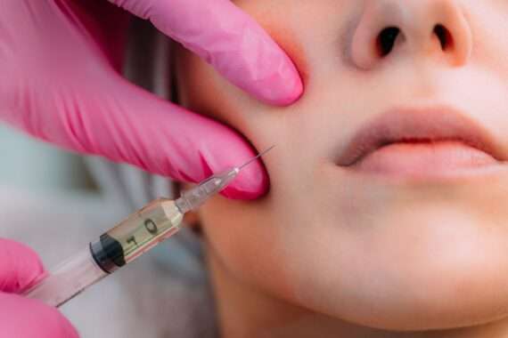 How Is Sculptra Different From Other Facial Fillers