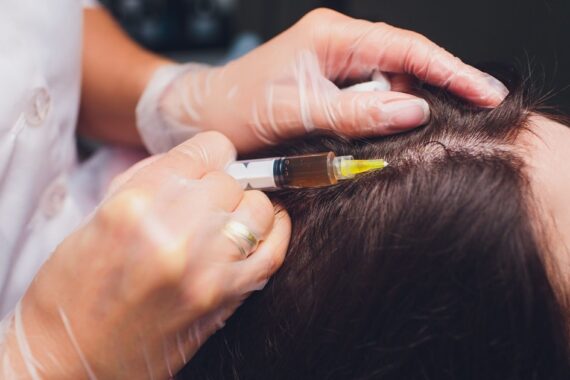 What is the Best Hair Loss Treatment