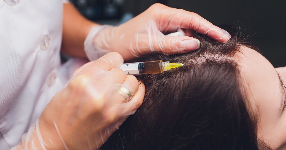 What is the Best Hair Loss Treatment