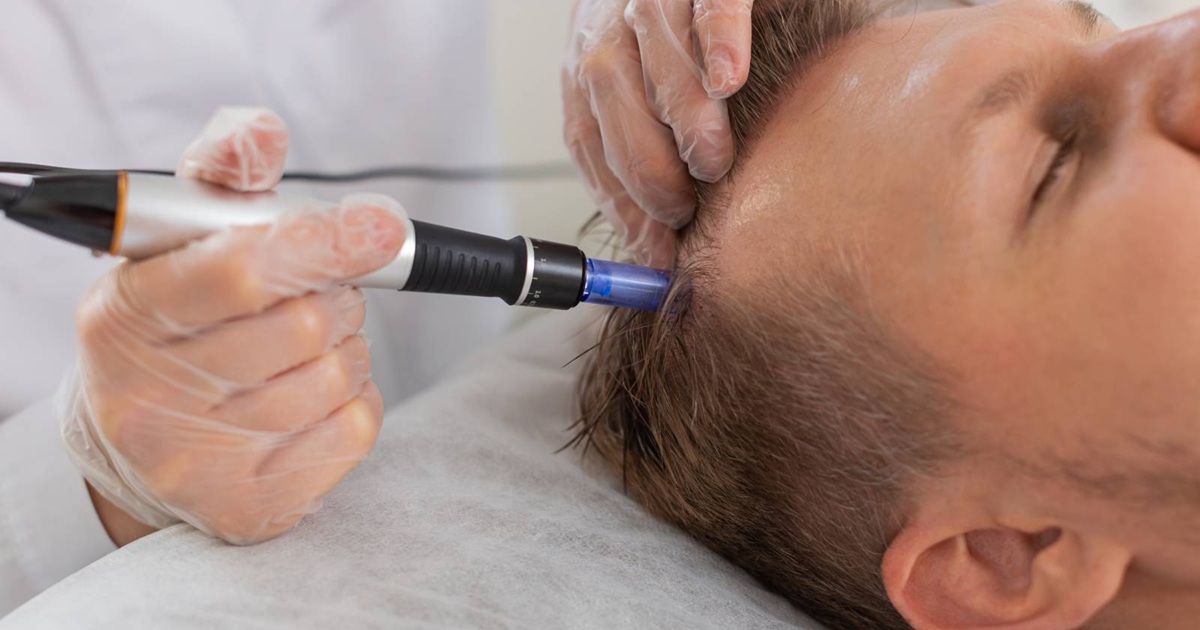 Exosome Therapy for Skin & Hair Regeneration