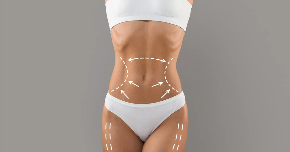 VASER vs Traditional Lipo Key Differences