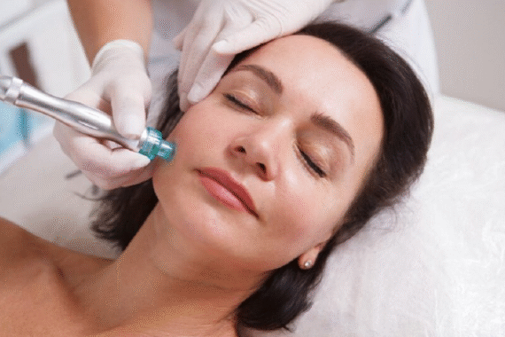 HydraFacial for Acne-Prone Skin Real Results