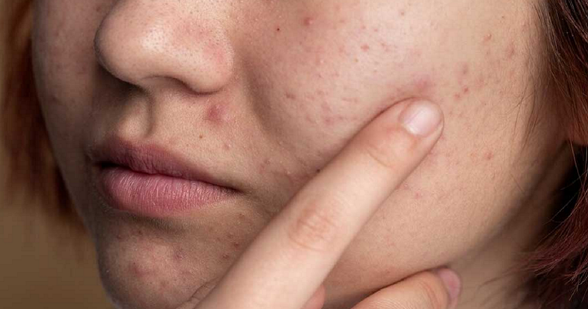 Does Drinking Coffee Affect Your Skin