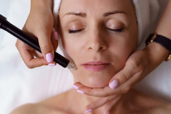 How HydraFacial Helps with Acne and Blackheads