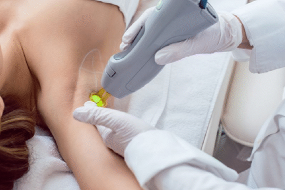 How Long Does Laser Hair Removal Last