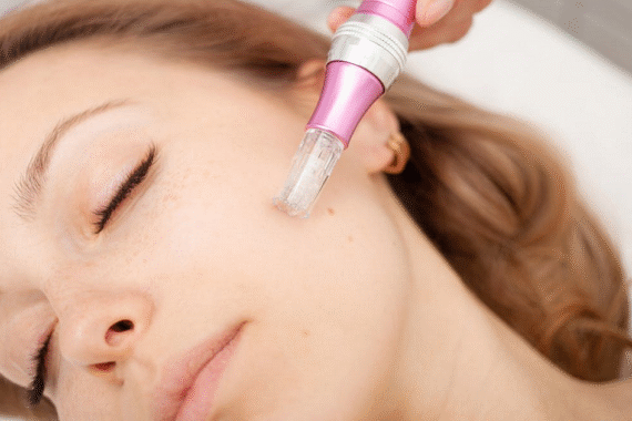 Is HydraFacial Painful or Safe for Sensitive Skin