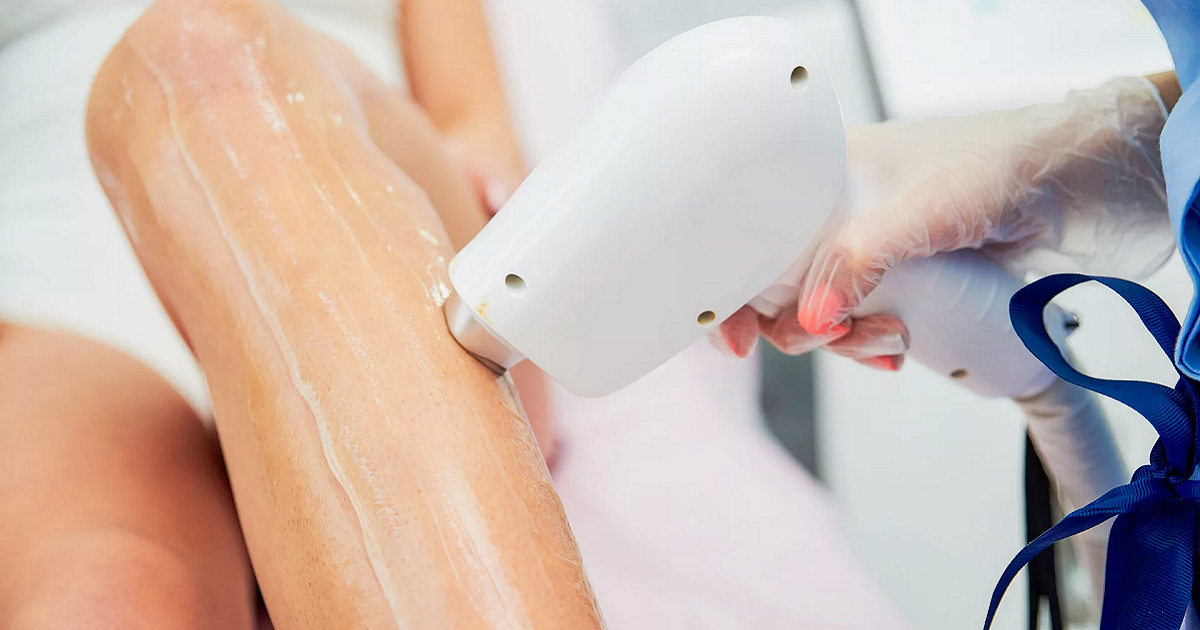 Permanent Hair Reduction with Laser Hair Removal