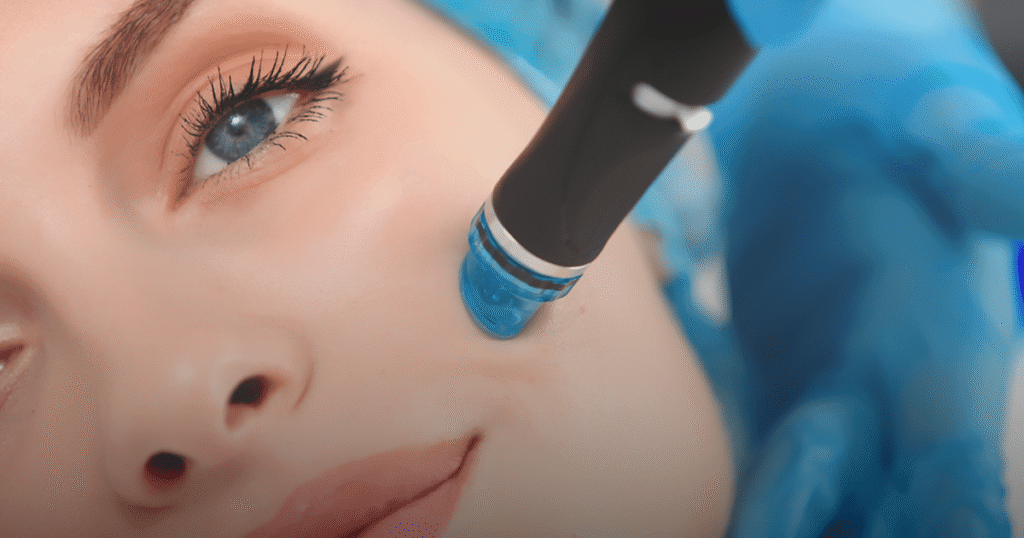 10 Benefits of Hydrafacial