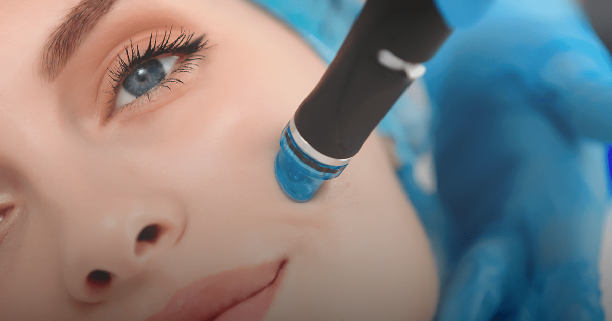 10 Benefits of Hydrafacial