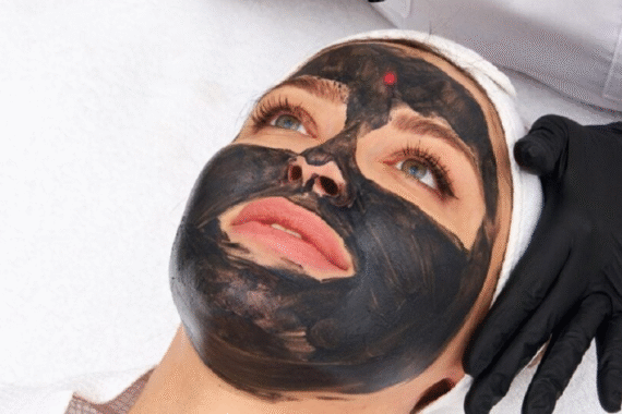 How Carbon Peel Improves Skin Tone, Texture, and Glow