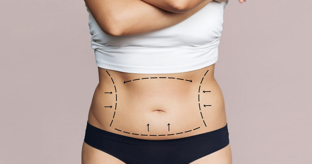 Liposuction for Men vs Women Differences and Results