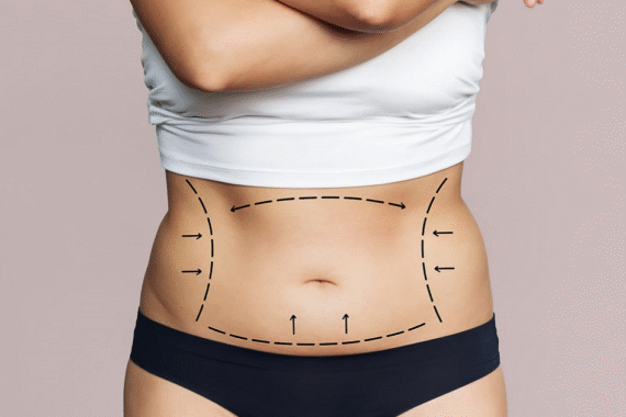 Liposuction for Men vs Women Differences and Results