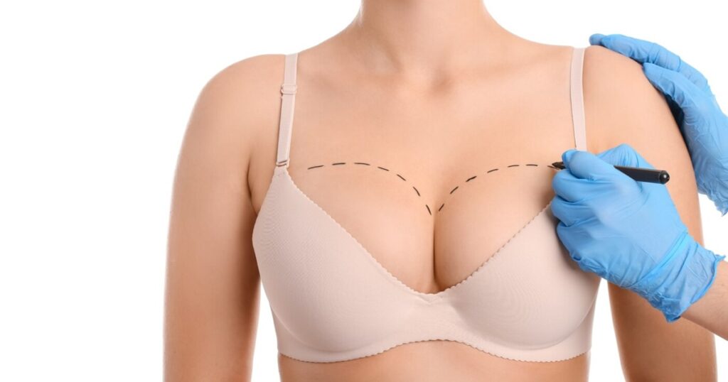 breast augmentation in islamabad