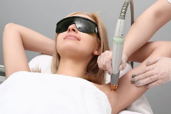 Laser Hair Removal in Islamabad for All Areas
