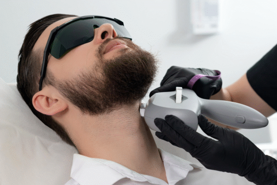Beard Shaping with Laser Hair Removal for Men