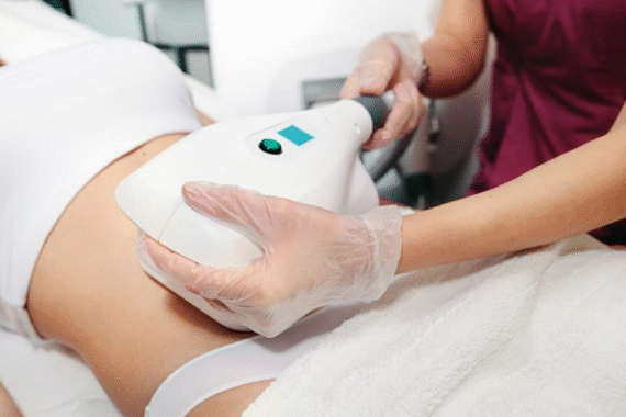 Expert Liposuction Treatment for Natural Body Contouring