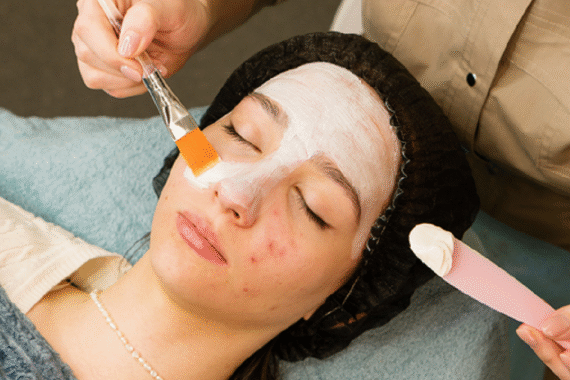Best Facial Treatment for Oily and Acne-Prone Skin
