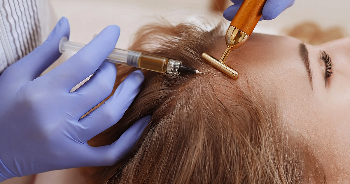 Hair PRP Treatment Benefits: Is It Really Effective?