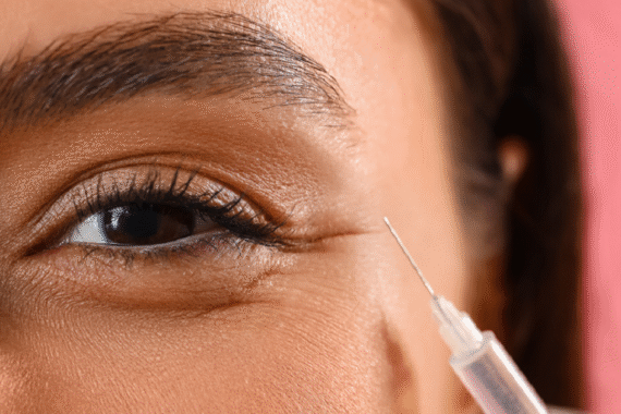 Dermal Fillers for Under-Eye Hollows Does It Work