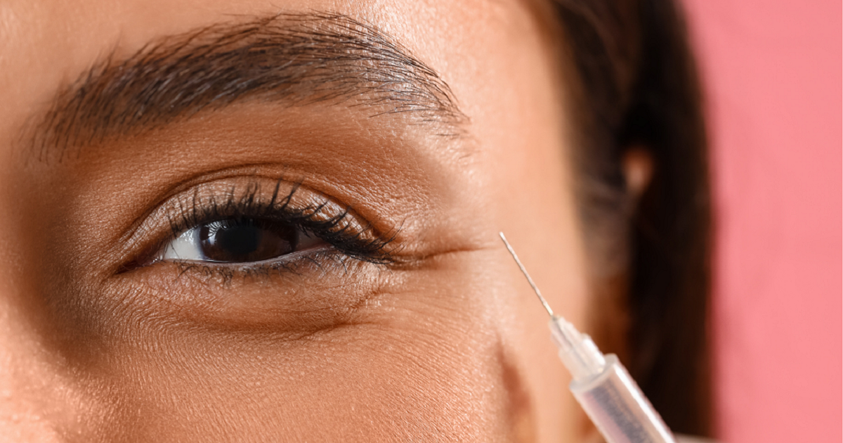 Dermal Fillers for Under-Eye Hollows: Does It Work?